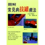 圖解常見病拔罐療法