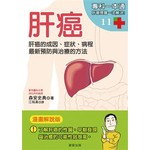 肝癌：肝癌的成因、症狀、病程 最新預防與治療的方法